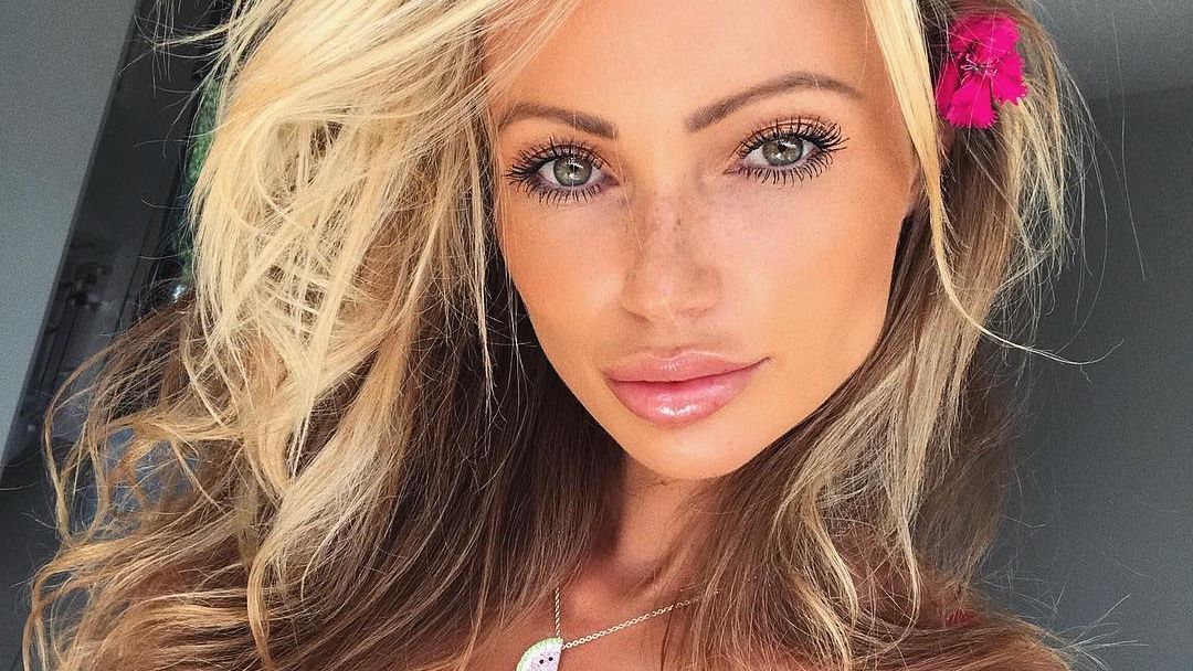 Abby Dowse plastic surgery