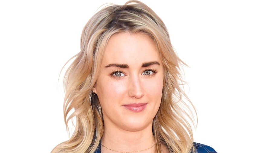 Ashley Johnson lip fillers