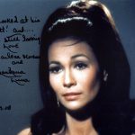 BarBara Luna botox nose job lips