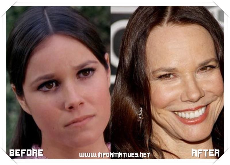 Barbara Hershey plastic surgery