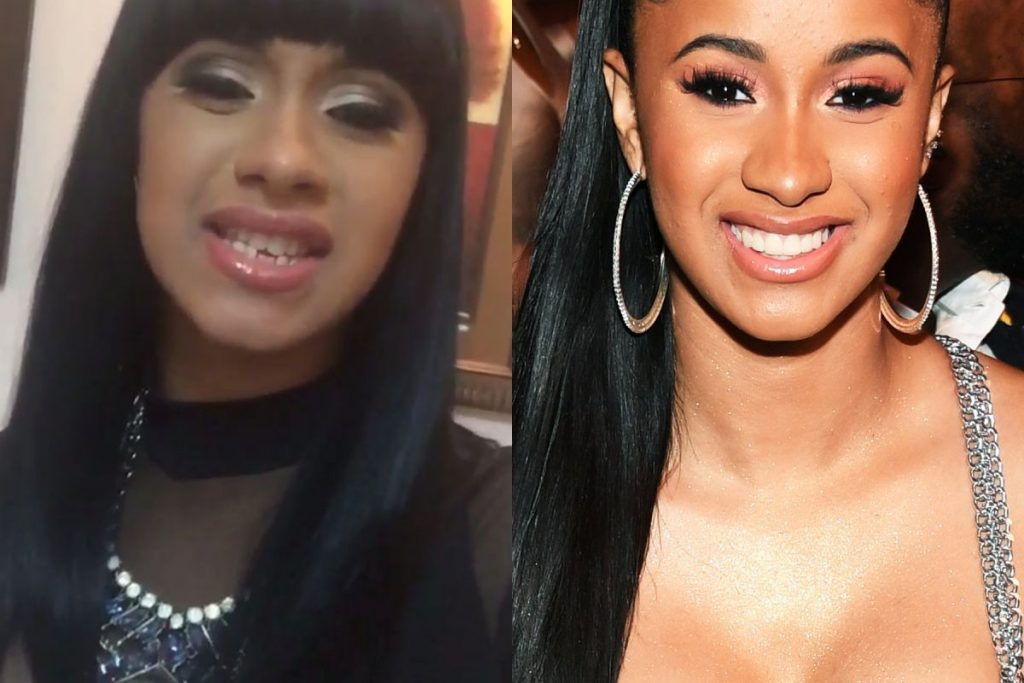 Cardi B Before and After Plastic Surgery Botox, Facelift, Body