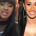 Cardi B botox facelift body measurements