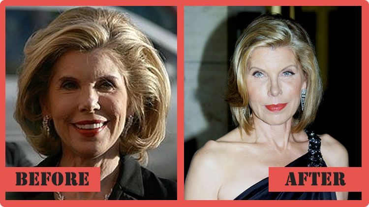 Christine Baranski nose job