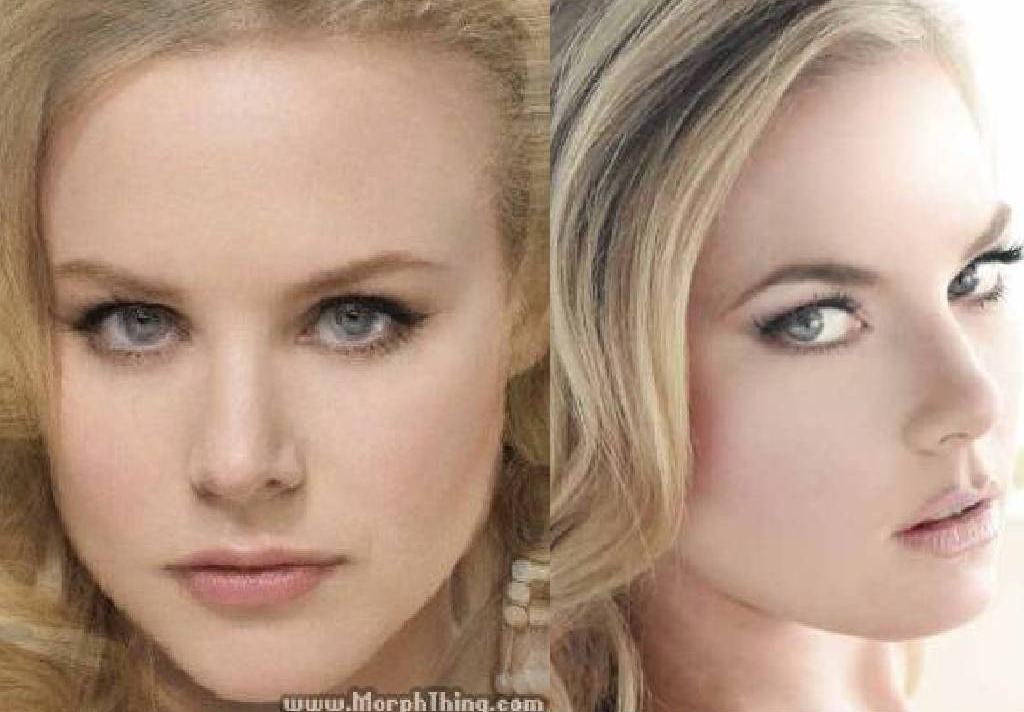 Cindy Busby botox