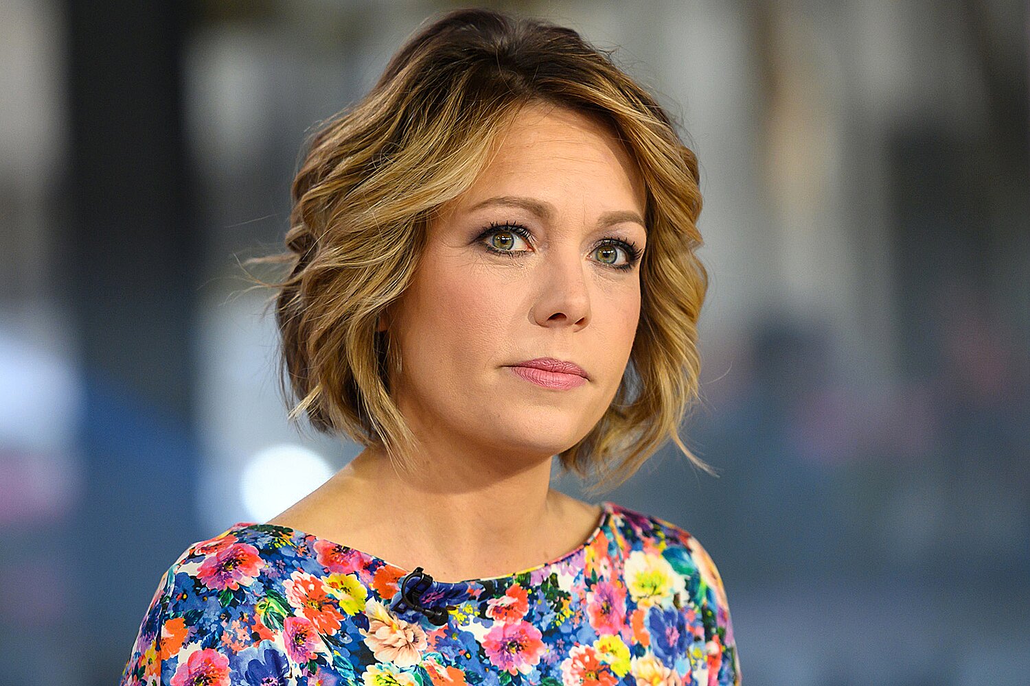 Dylan Dreyer lip fillers