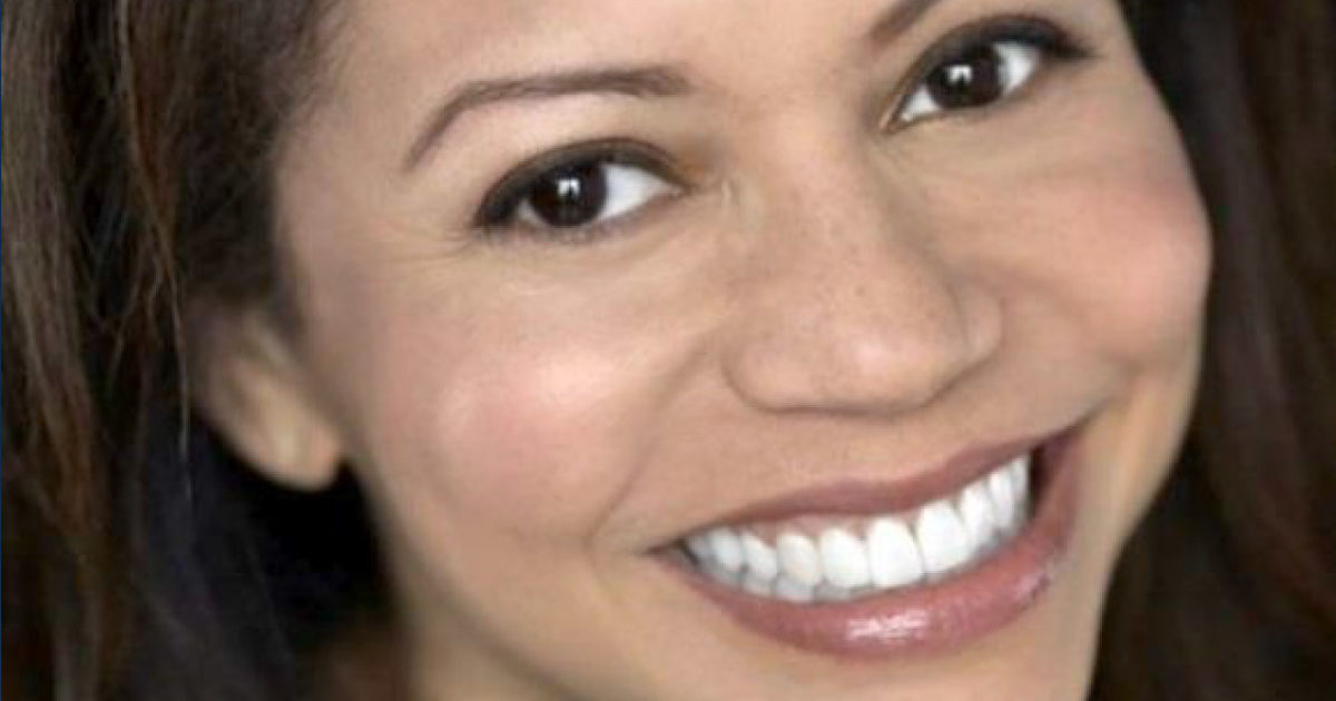 Gloria Reuben botox