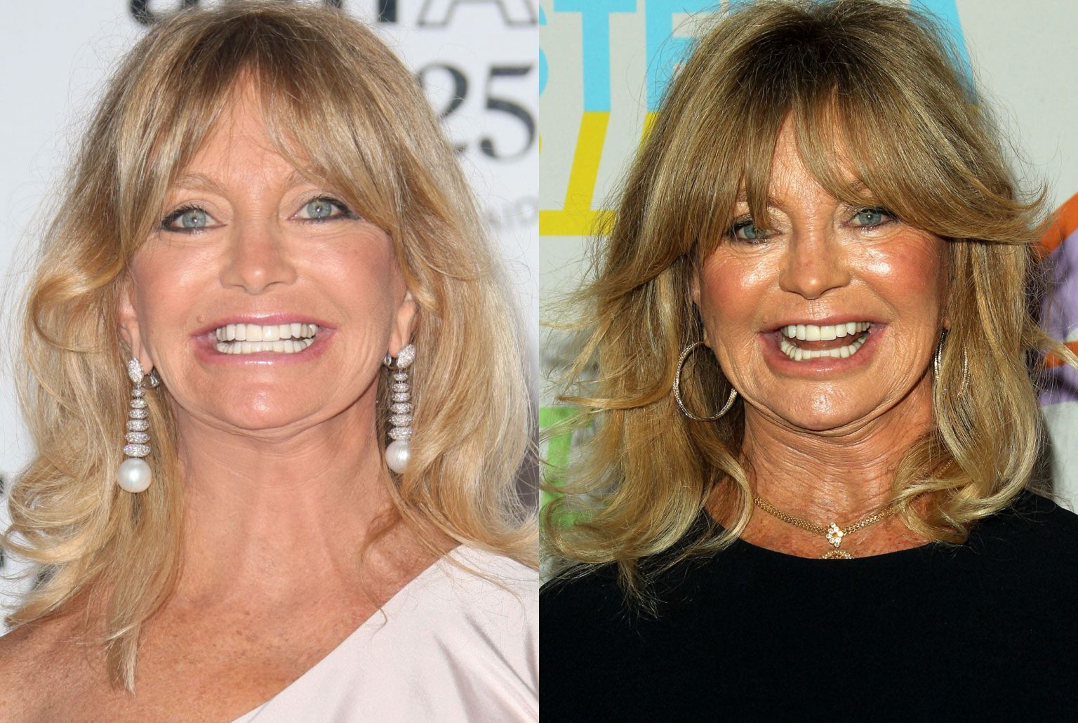 Goldie Hawn Plastic Surgery - Before and After. Lips, Botox, Boob Job ...