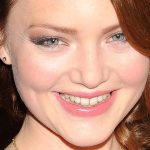 Holliday Grainger botox lips nose job