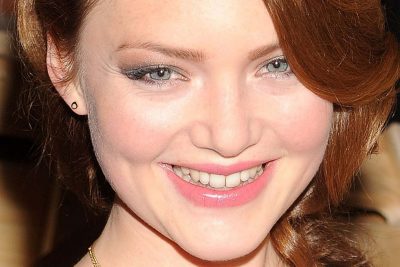 Holliday Grainger botox lips nose job
