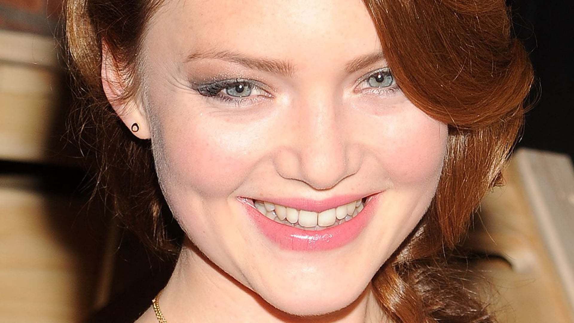 Holliday Grainger botox lips nose job