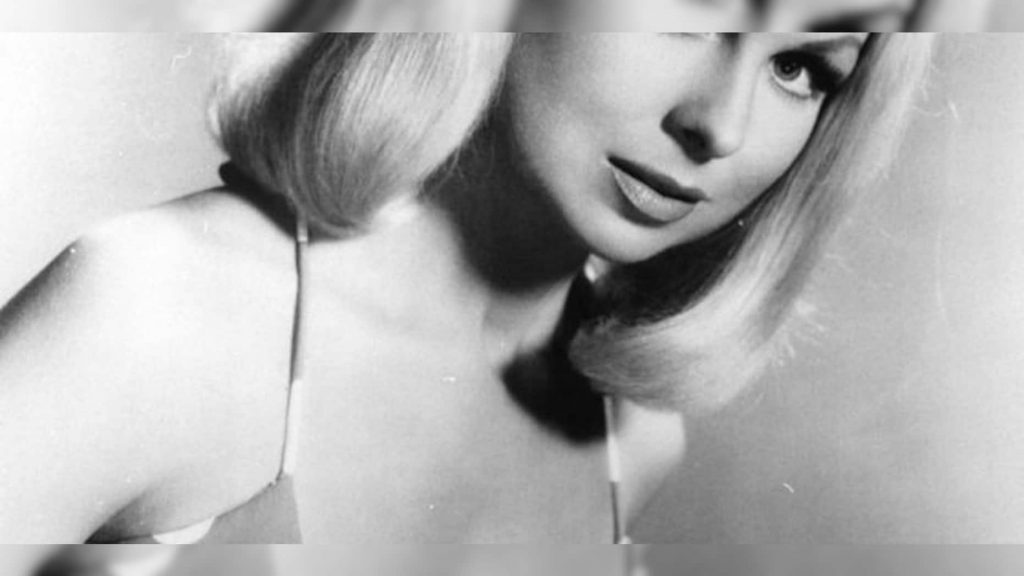 Joi Lansing lip fillers