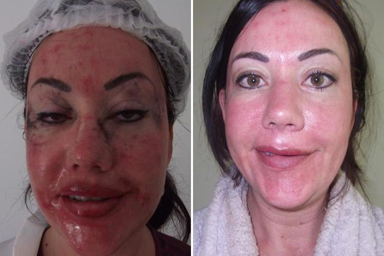 Has Lisa Appleton had Plastic Surgery? Facelift, Lips, Boob Job, and More!