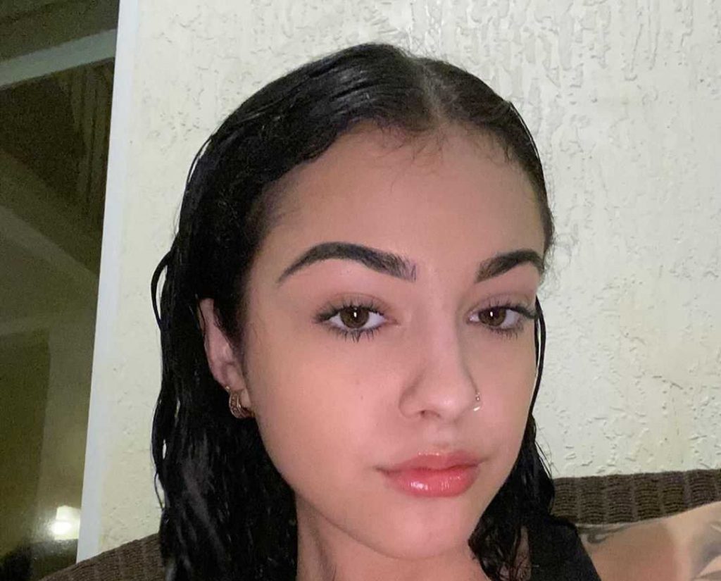 Malu before and after surgery