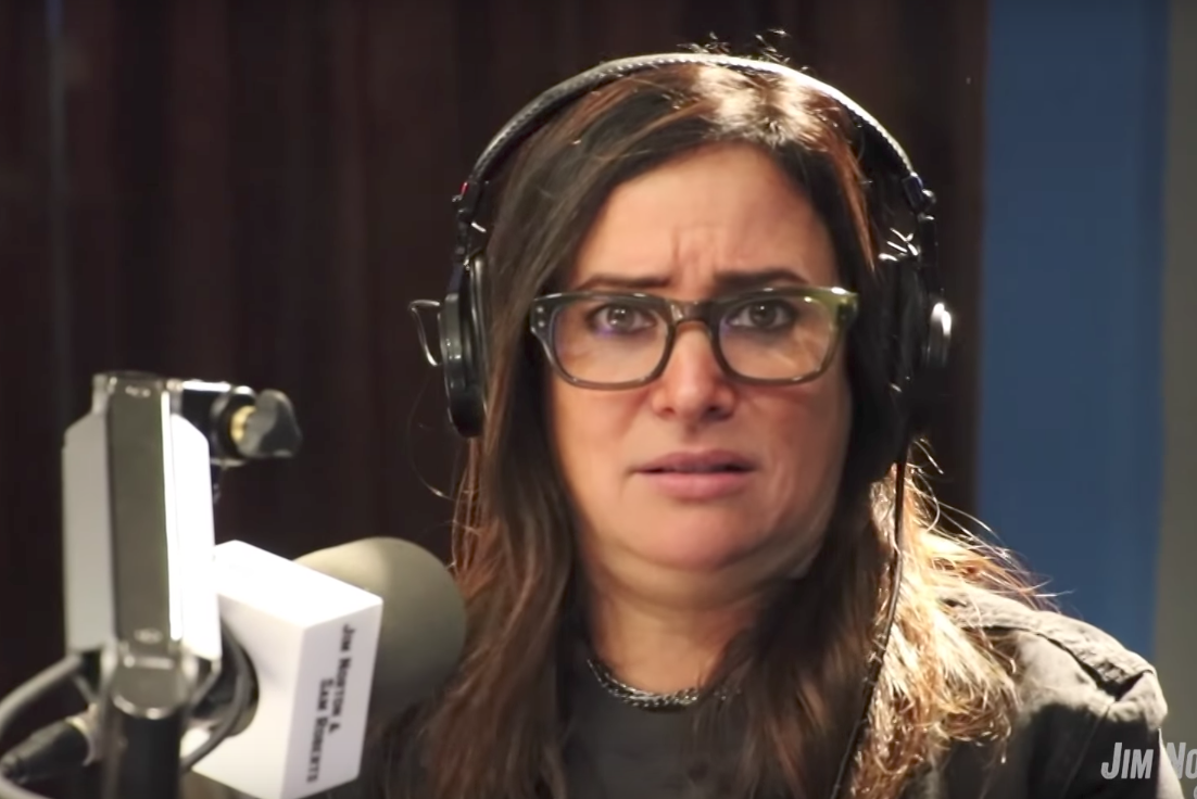 Pamela Adlon botox