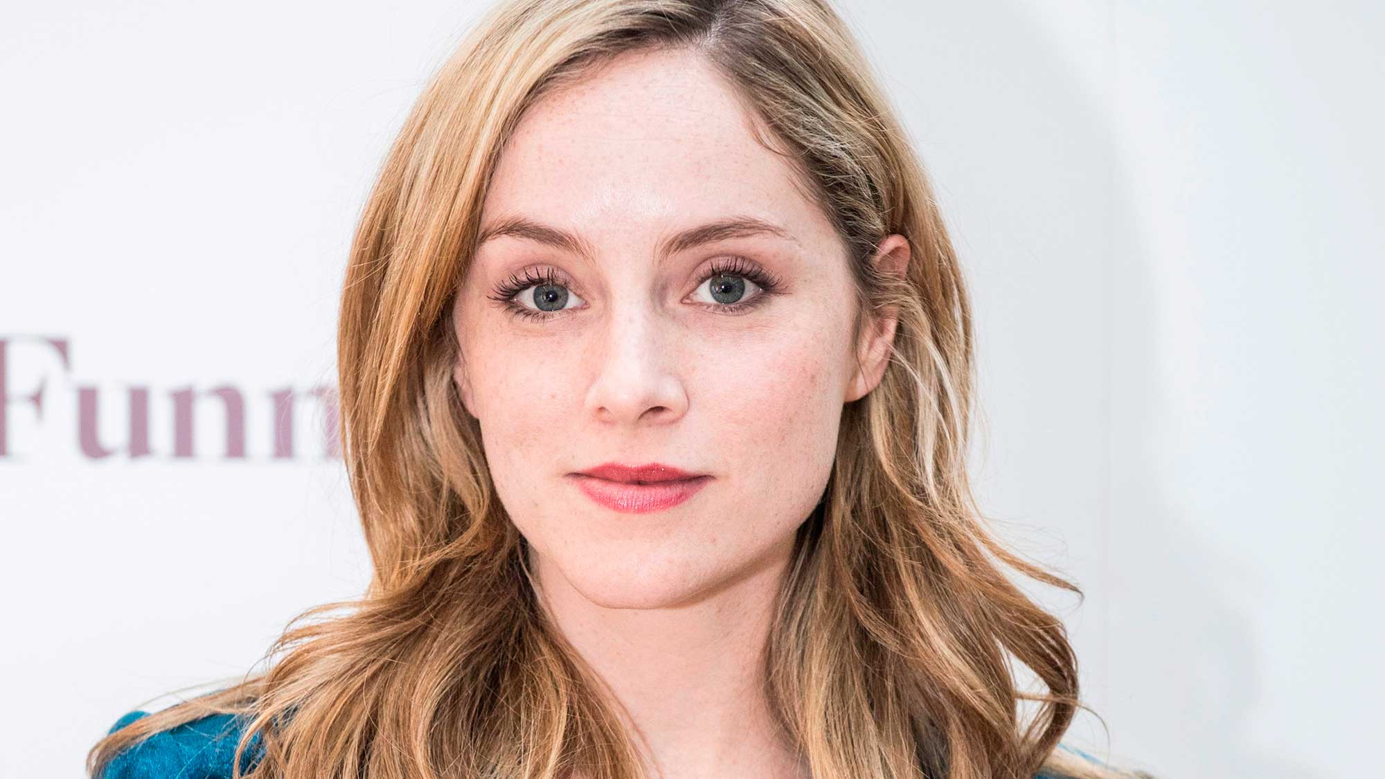 Sophie Rundle plastic surgery