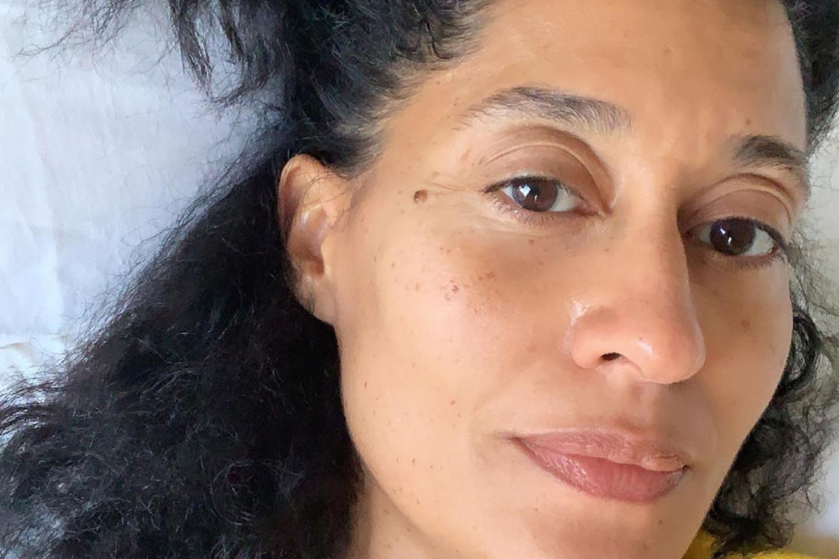 Tracee Ellis Ross botox