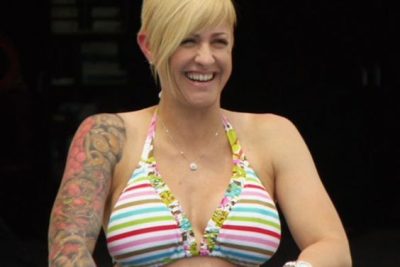 Christie Brimberry Plastic Surgery