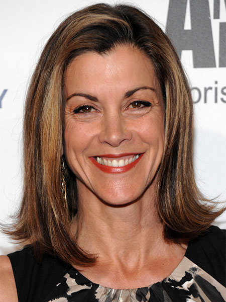 Wendie Malick Cosmetic Surgery Face