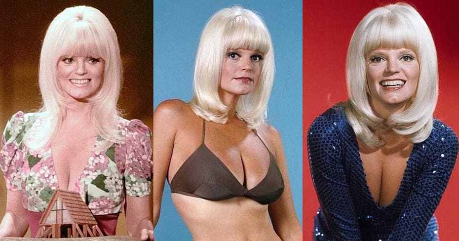 Carol Wayne Cosmetic Surgery Body