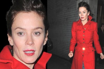 Anna Friel Plastic Surgery