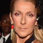 Celine Dion Plastic Surgery