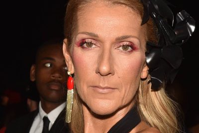 Celine Dion Plastic Surgery