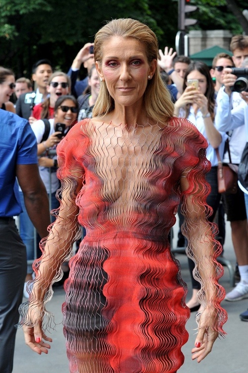 Celine Dion Plastic Surgery Body