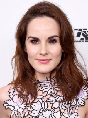 Michelle Dockery Cosmetic Surgery Face