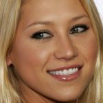 Anna Kournikova Plastic Surgery and Body Measurements