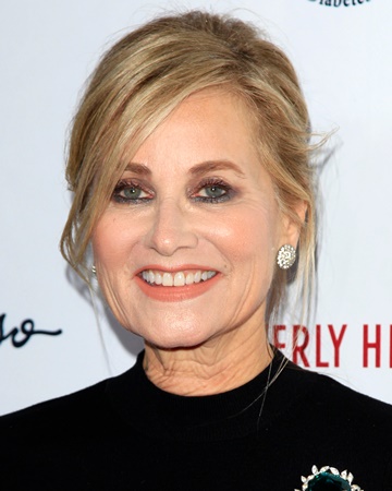 Maureen McCormick Cosmetic Surgery Face