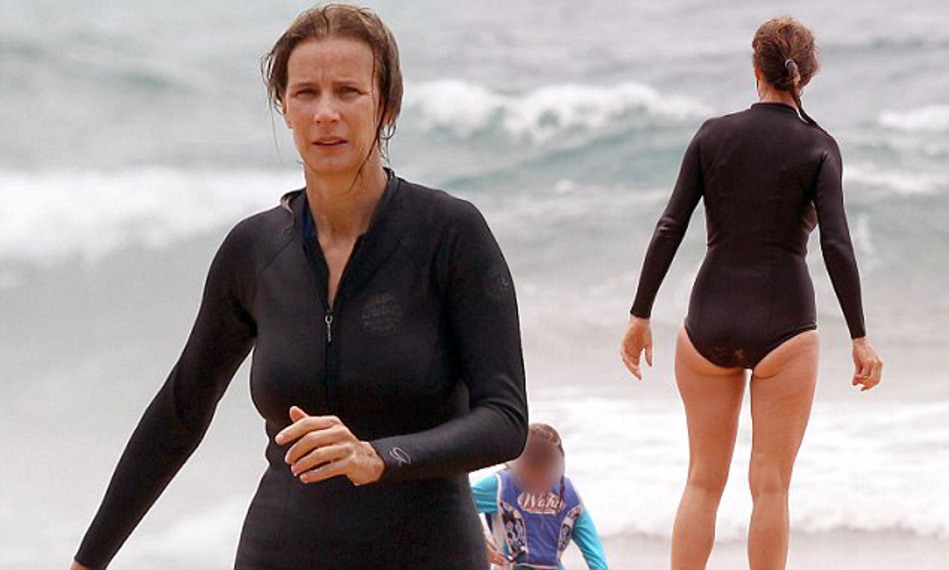 Rachel Griffiths Cosmetic Surgery Body