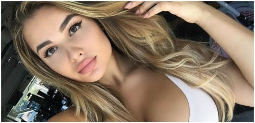 Anastasiya Kvitko Cosmetic Surgery Face