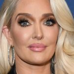 Erika Jayne Cosmetic Surgery Nose Job Botox