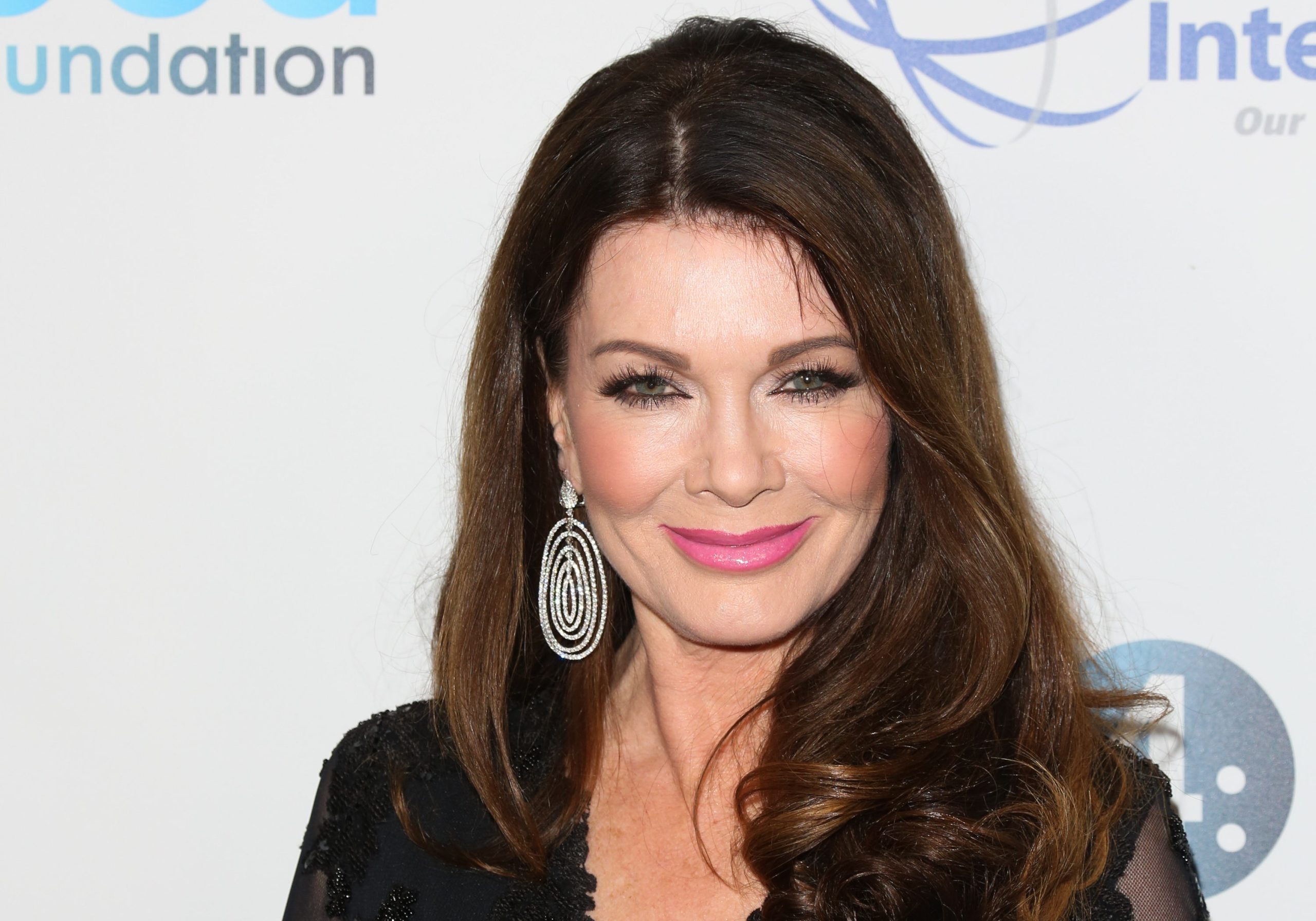 What Plastic Surgery Has Lisa Vanderpump Done?