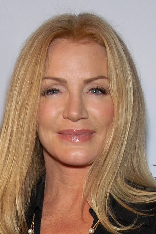 Shannon Tweed Facelift Plastic Surgery