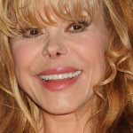 Charo Cosmetic Surgery Nose Job Boob Job Facelift Fillers