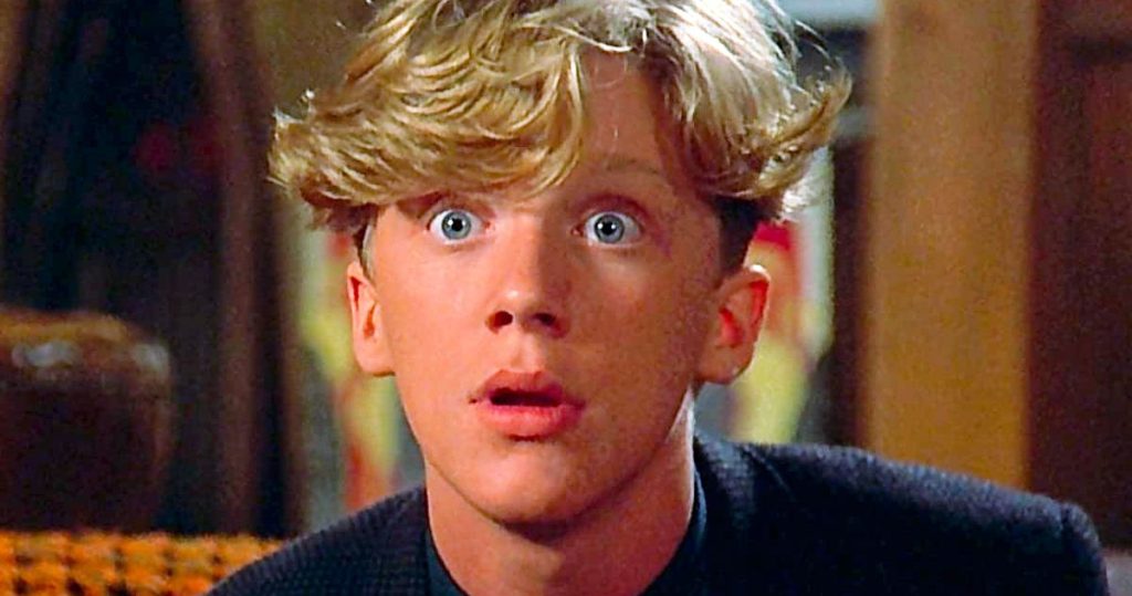 Anthony Michael Hall Plastic Surgery Face