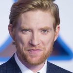 Domhnall Gleeson Cosmetic Surgery