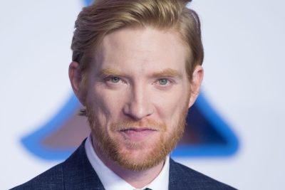 Domhnall Gleeson Cosmetic Surgery