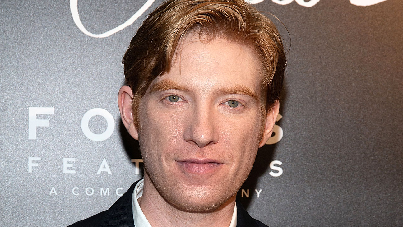 Domhnall Gleeson Cosmetic Surgery Face