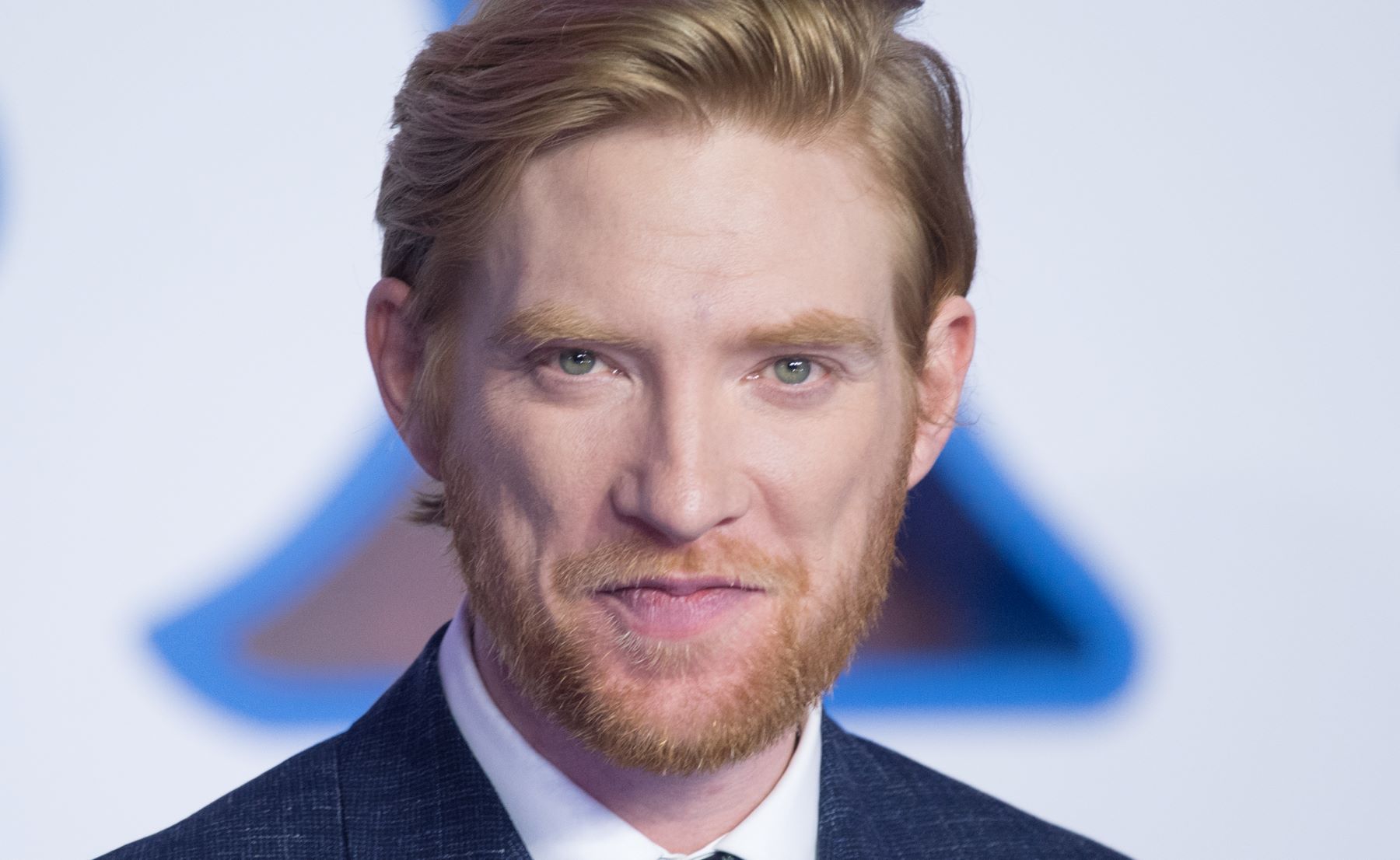 Domhnall Gleeson Cosmetic Surgery