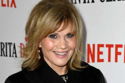 Markie Post Plastic Surgery