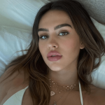 Amelia Gray Breast Reduction