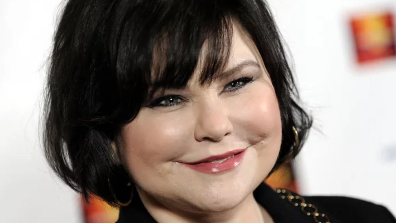 What Plastic Surgery Has Delta Burke Had?