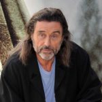 Ian McShane Cosmetic Surgery