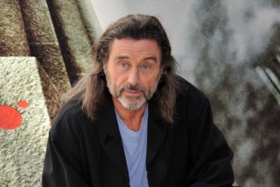 Ian McShane Cosmetic Surgery