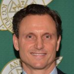 Tony Goldwyn Plastic Surgery Procedures