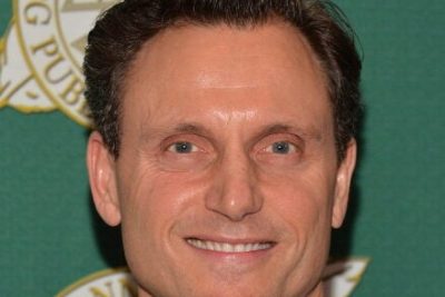 Tony Goldwyn Plastic Surgery Procedures