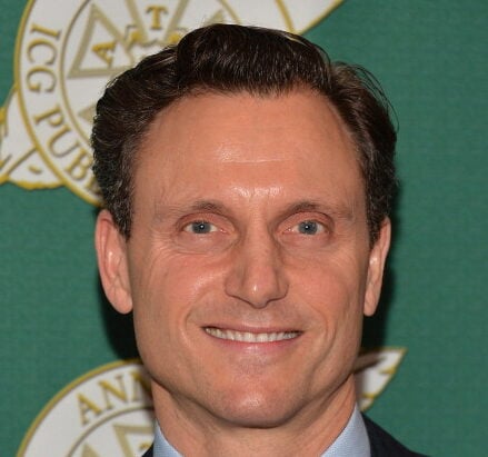 Tony Goldwyn’s Plastic Surgery – What We Know So Far