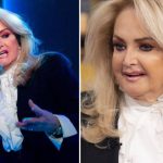 Bonnie Tyler Plastic Surgery Procedures